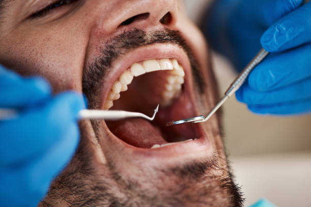 Best Urgent Dental Care for Toothache in Fife Heights, WA